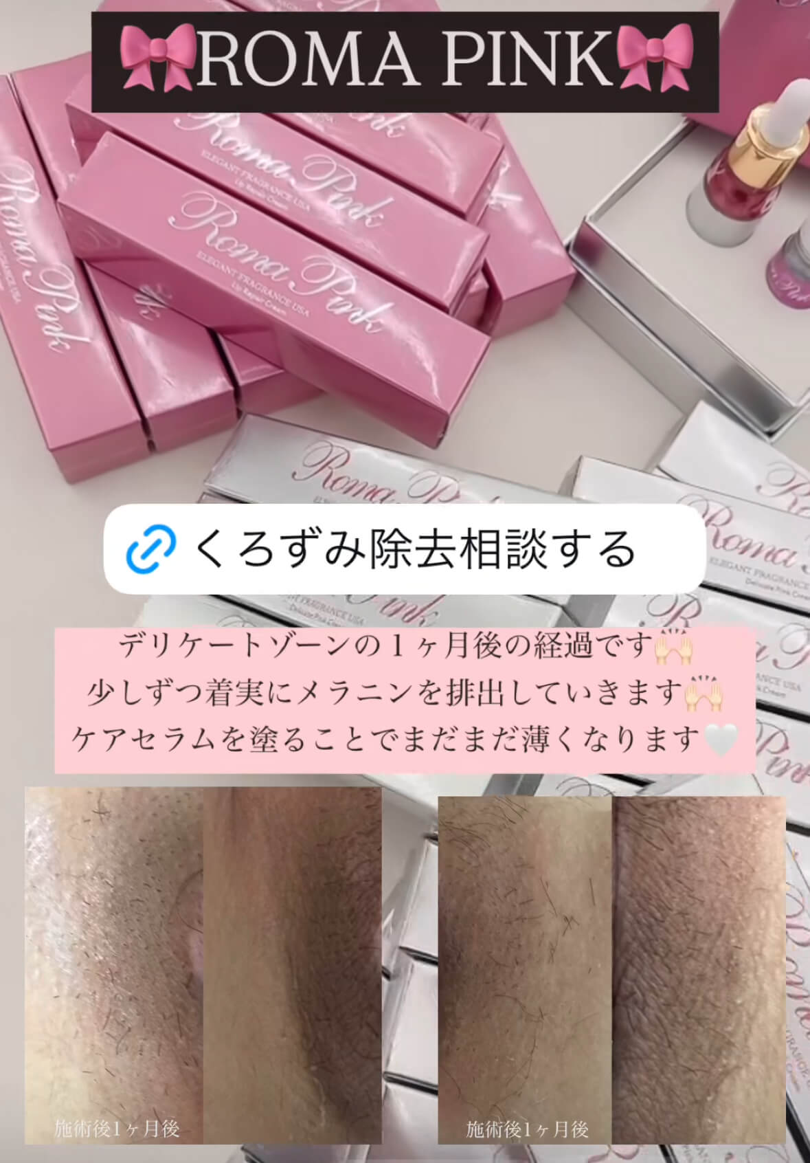 ローマピンク】メラニンのみを排出させるROMA PINK🎀【メラニン除去