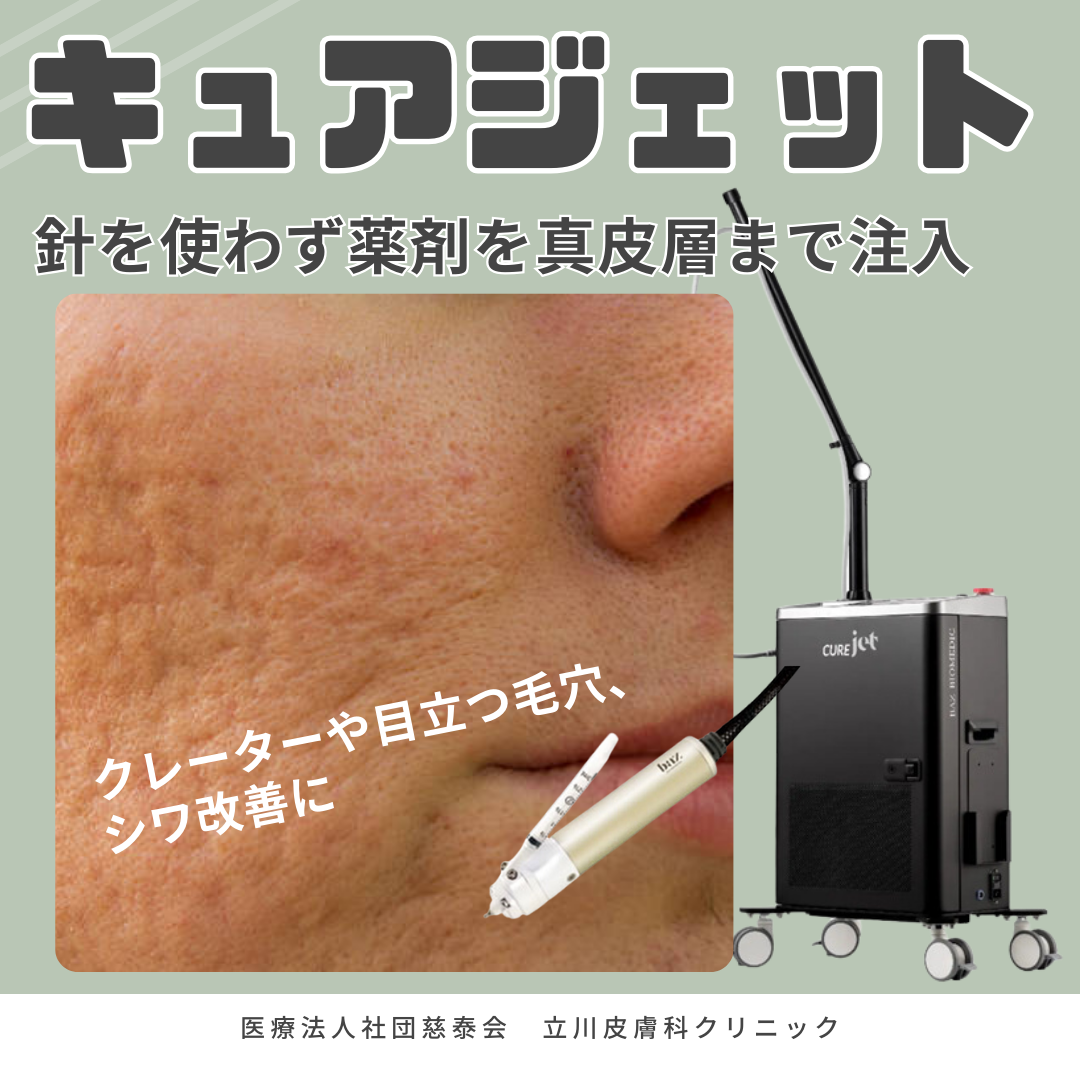 新治療coming soon✨キュアジェット（Cure jet） ｜立川皮膚科