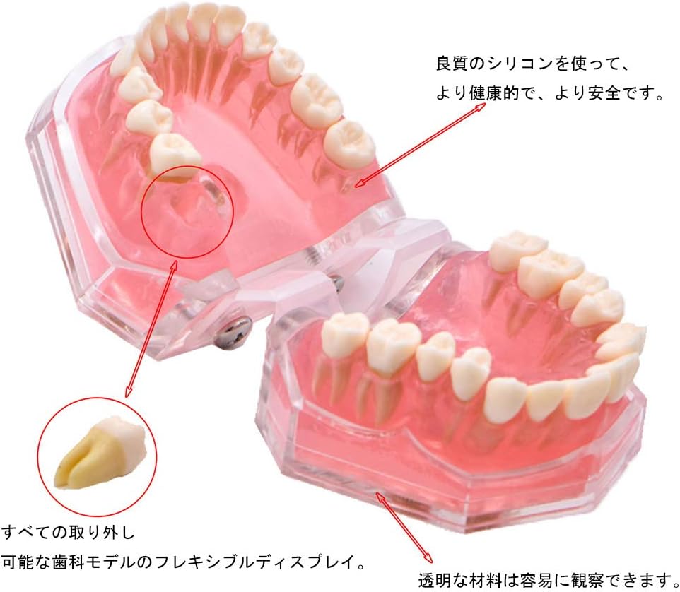 楽天市場】歯列模型 歯が抜く説明モデル 説明モデル 教学モデル 歯科