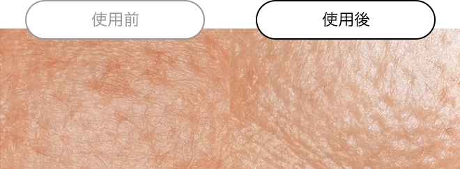 クエスク メディックス EXシリーズ | スキンケア化粧品・サイエンス