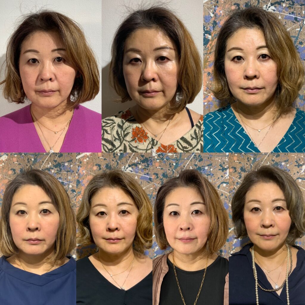 知っておいて！フェイスポインターのメリット・デメリット | 顔道（KAO