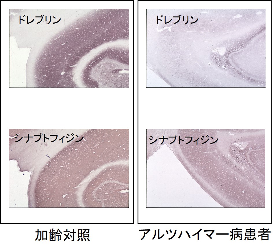 ドレブリン研究のデファクトスタンダード抗体（M2F6）がさらに高品質に