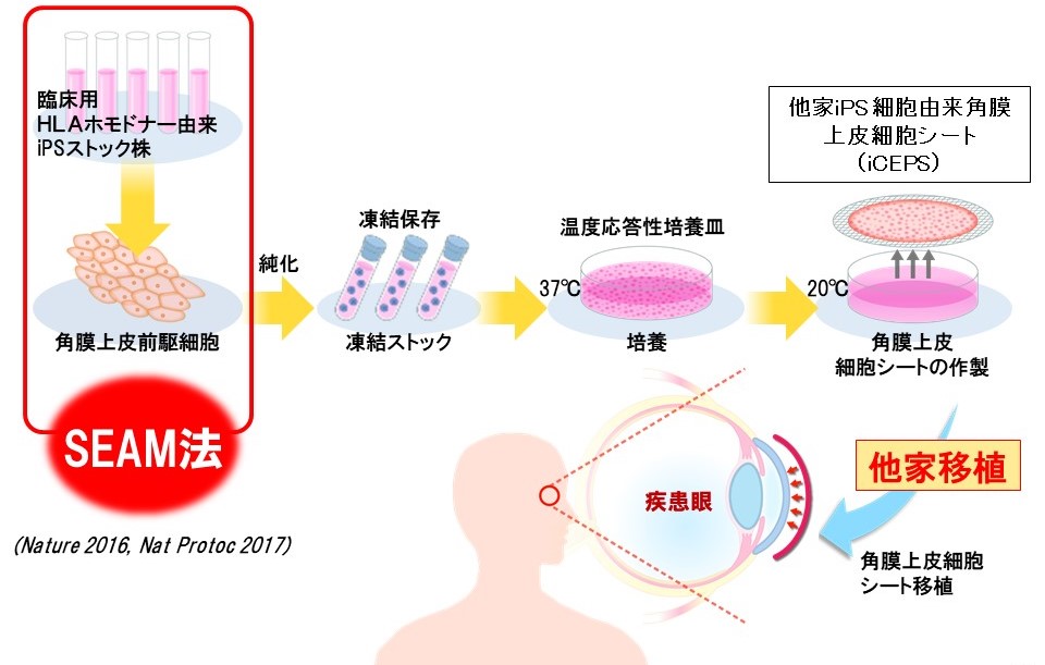 iPS 細胞から作製した角膜上皮細胞シートの臨床研究開始について