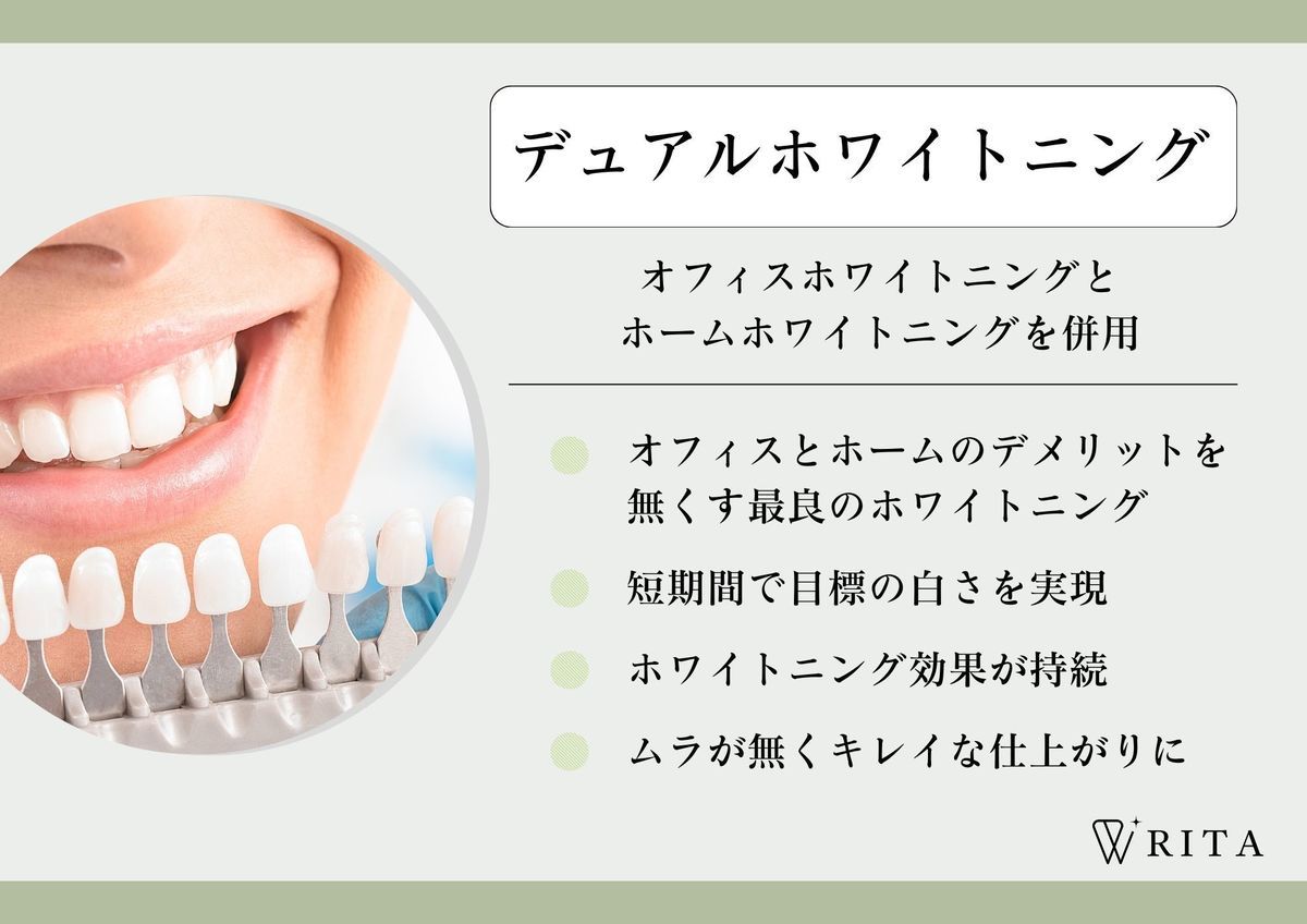 ホワイトニング RITA - 歯科ミントクリニック（富山県滑川市）