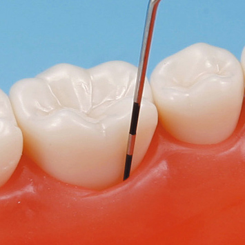 SRP用顎模型 [D16HD-500H(GSF)-MF](咬合器なし)｜株式会社ニッシン