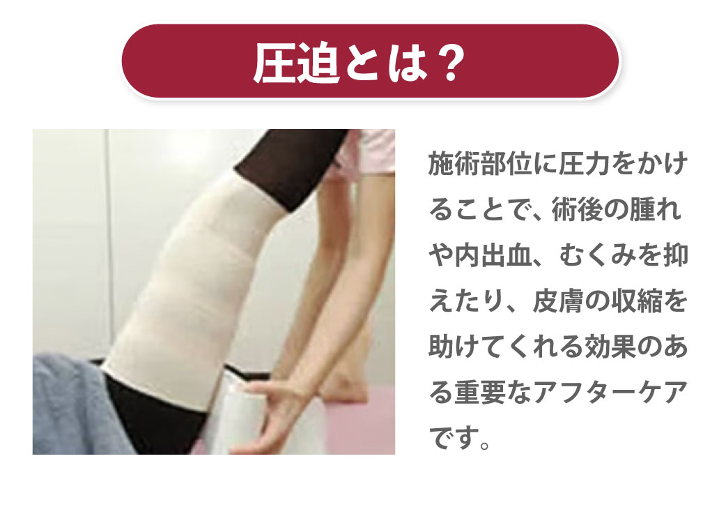 脂肪吸引の圧迫はいつまですればいい？しなかった場合はどうなるのかも