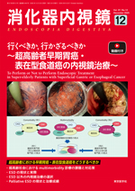 消化器内視鏡37巻12号（12月号）|東京医学社
