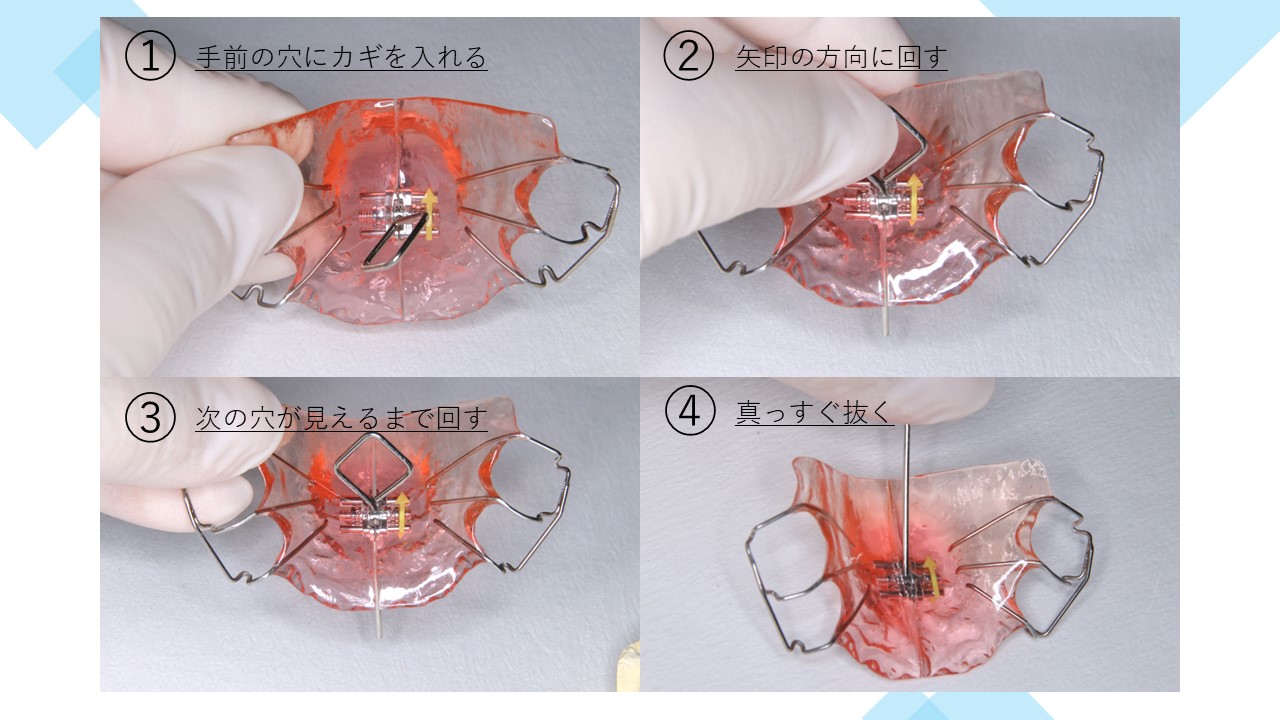 拡大装置（拡大床）の使い方｜ネジの回し方・注意点・お手入れ方法