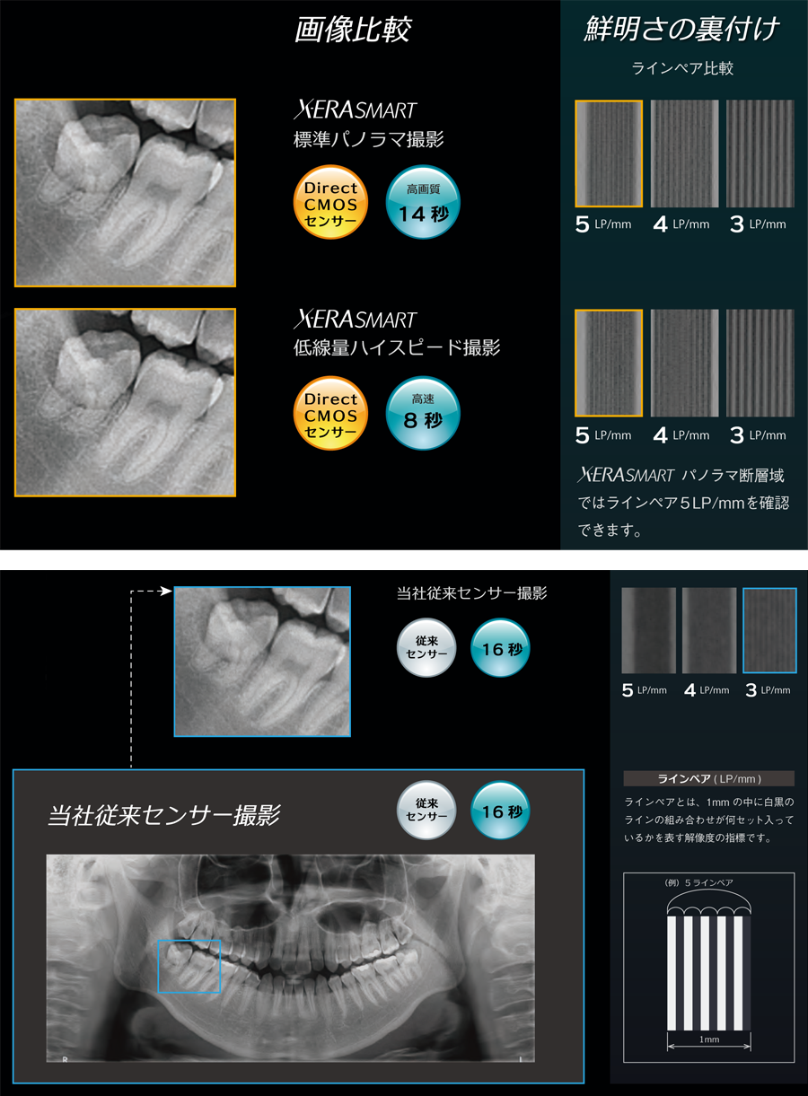 歯科医療機器の吉田製作所 | エクセラスマートF+ 高画質パノラマ撮影