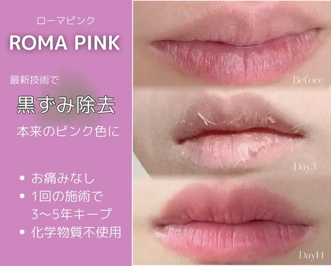 ブログ | 宮城県仙台のフェイシャルエステなら肌質改善サロンAngel