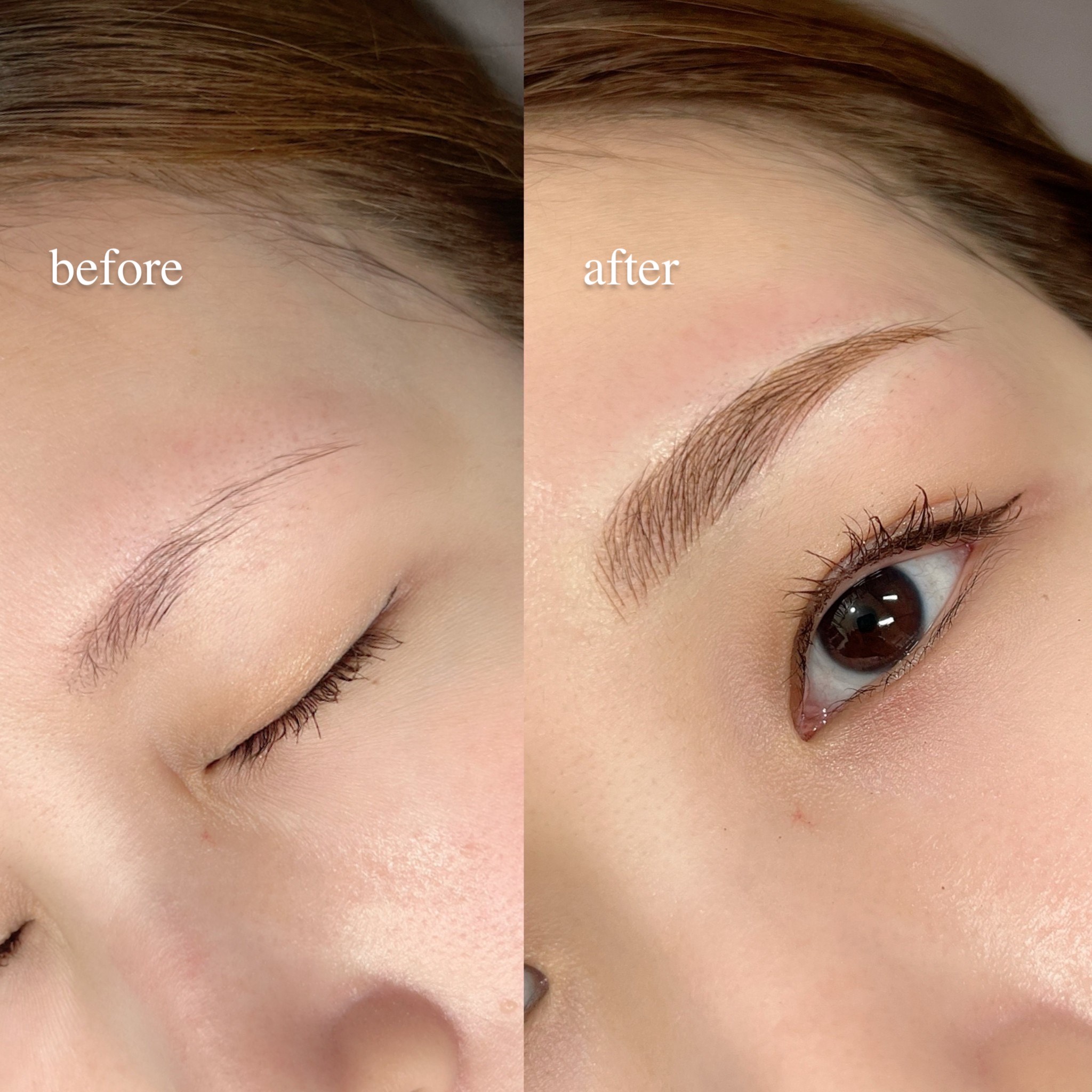 医療アートメイク - 芦屋ファミリークリニック形成外科皮フ科