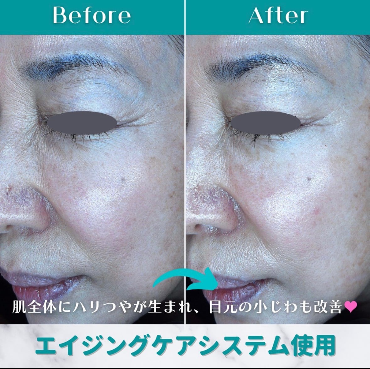 8e94db4122ceb234c7b1c85b21ad9b