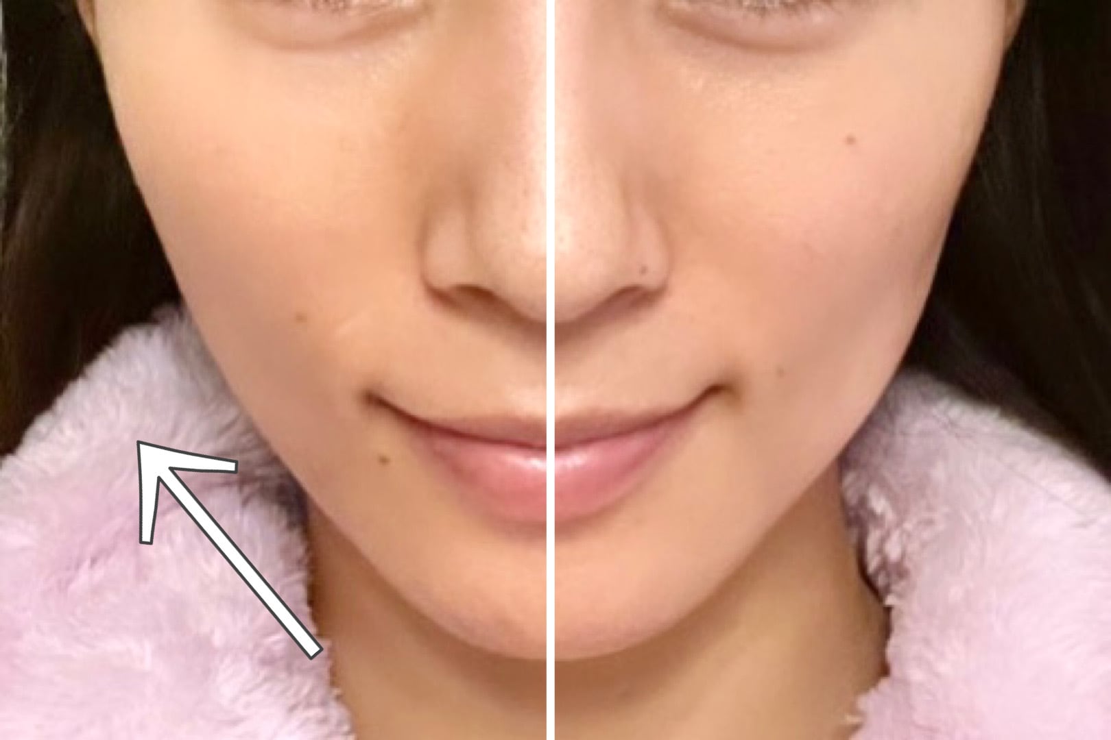 プラズマニードル カリファ【このひとつで、世界が変わる】 | BEAUTY