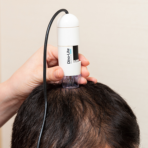 薄くなった夫も劇的変化！【AGAクリニック・アデランス】2020年最新