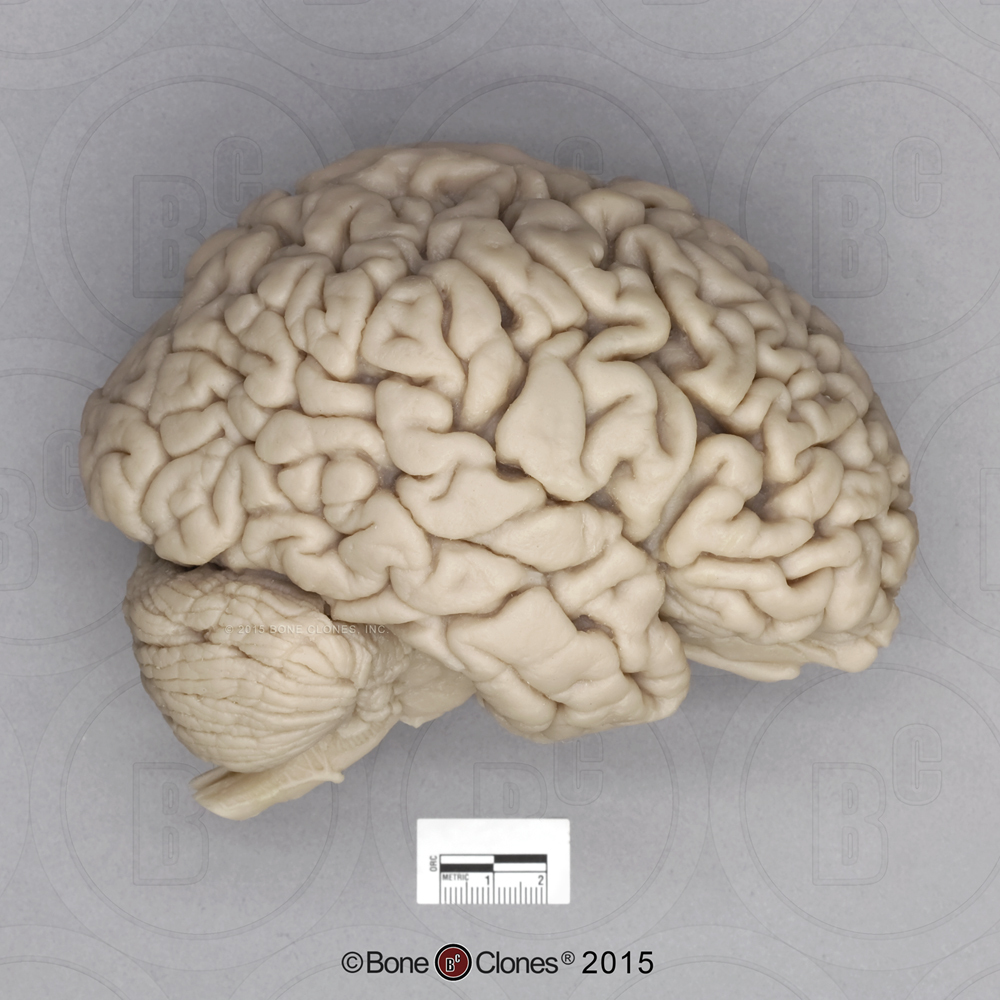 Human Brain - Bone Clones - Osteological Reproductions