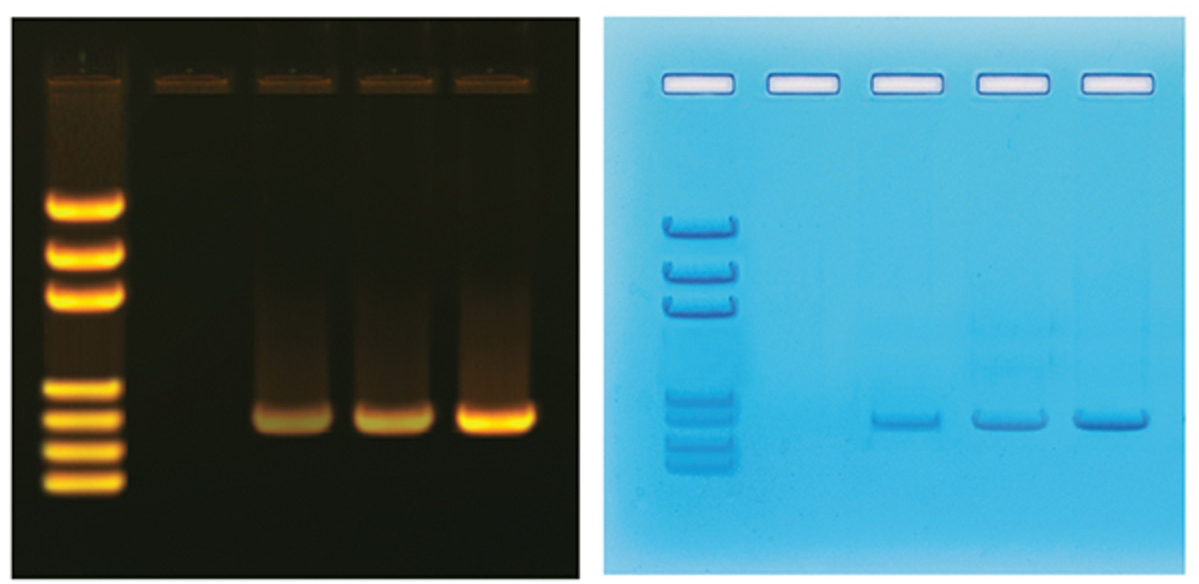 Biotech Basics – Visualizing DNA – The Official Blog of Edvotek®