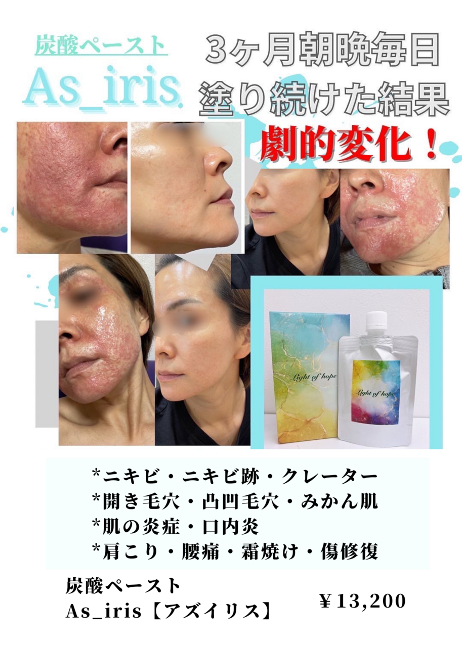アズイリス 【代理店】ご購入はこちらから✨ 炭酸ガスペーストパック