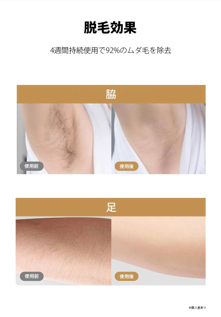 楽天市場】家庭用 IPL脱毛器 レーザー W-1091【美容 ムダ毛処理 ムダ毛