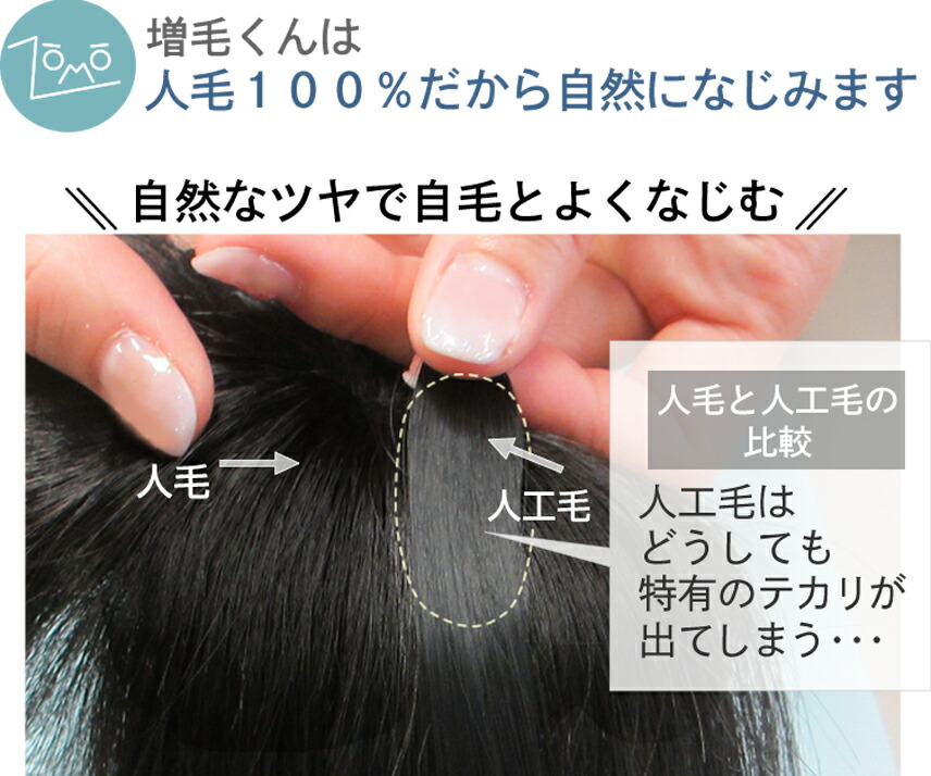 楽天市場】生え際全体にプラス！増毛くんシリーズはえぎわくん【L