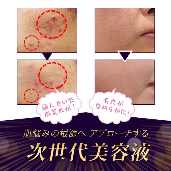 セルロジーコスメ] リッチエッセンス 30mL (ホームケア用)の通販