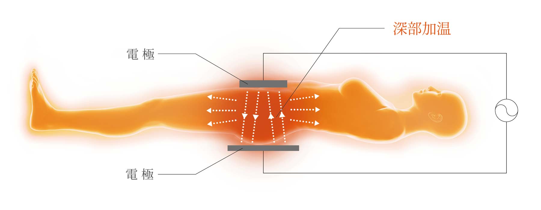 WHAT's INDIBA® | INDIBA JAPAN - インディバ・ジャパン
