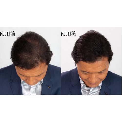 スーパーミリオンヘアー No.23 ミディアムブラウン ( 30g*3個セット