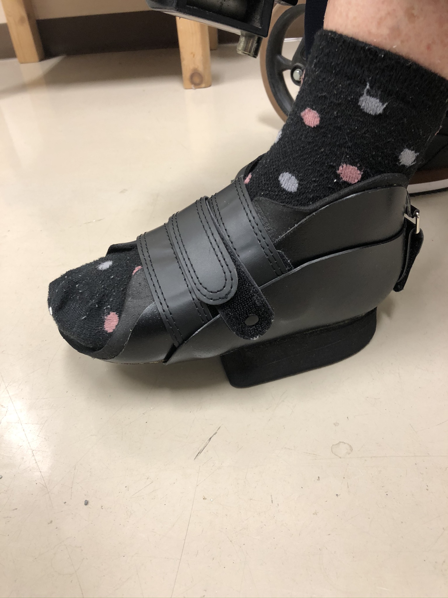 オリジナル中足骨骨折用装具 - 株式会社ケイ・ブレース ( 熊本県菊池市