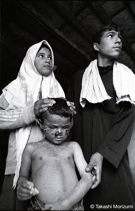 湾岸戦争の子どもたち IRAQ1998－2002｜UnoFOTO 京都写真美術館