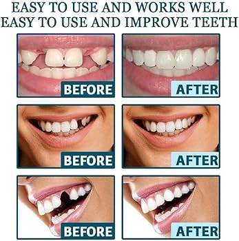 Amazon.co.jp: 2組の 入れ歯、義歯 男性と女性の義歯、つけ歯、 つけば