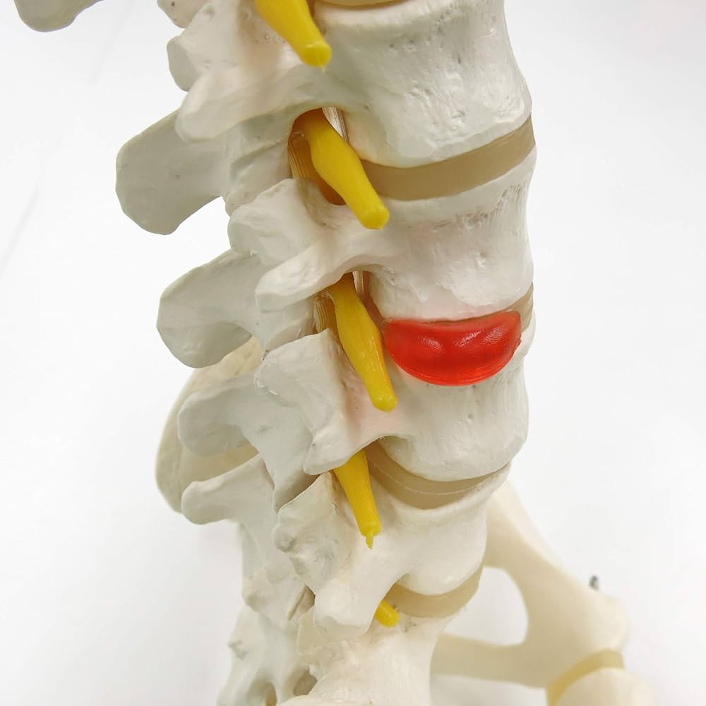 Amazon.co.jp: 脊柱模型 - 脊柱可動型モデル，大腿骨付 - 3B