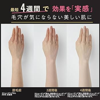 Amazon | JOVS Dora SRモード搭載 脱毛器 家庭用 光美容器 VIO対応 だ