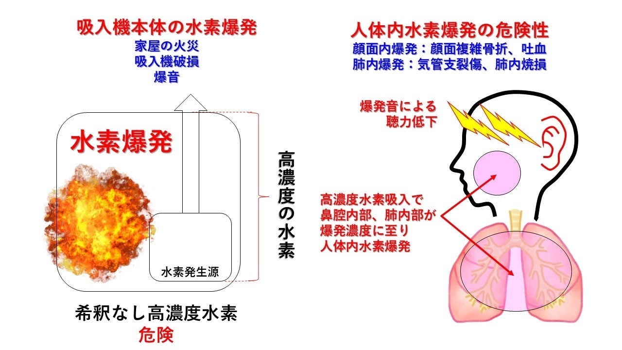 MiZ株式会社「高濃度水素吸入器による人体内水素爆発事故」に関する