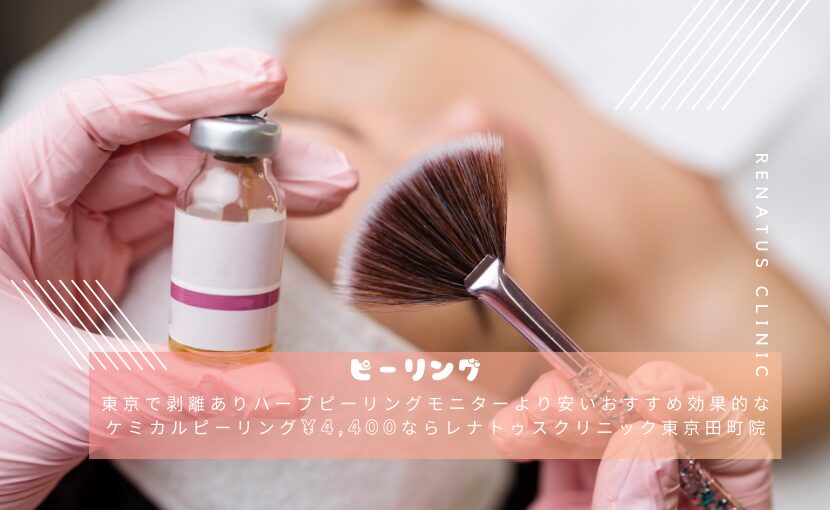 東京剥離ありハーブピーリングより安い効果おすすめケミカルピーリング