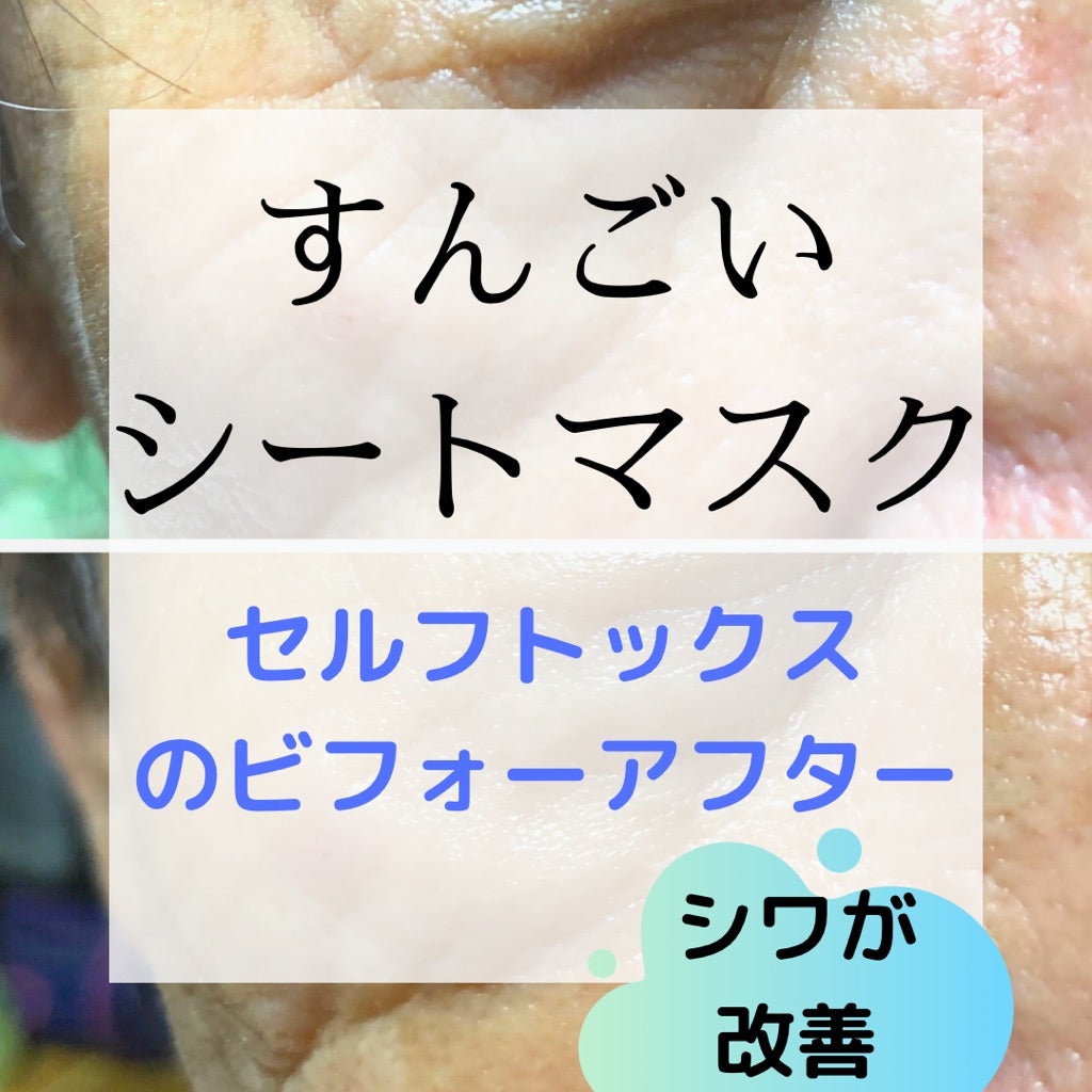 ☆すんごいシートマスク セルフトックスでシワを撃退ビフォーアフター