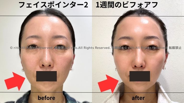 フェイスポインターがリニューアル！ポスポスの違いは？効果は？値段は